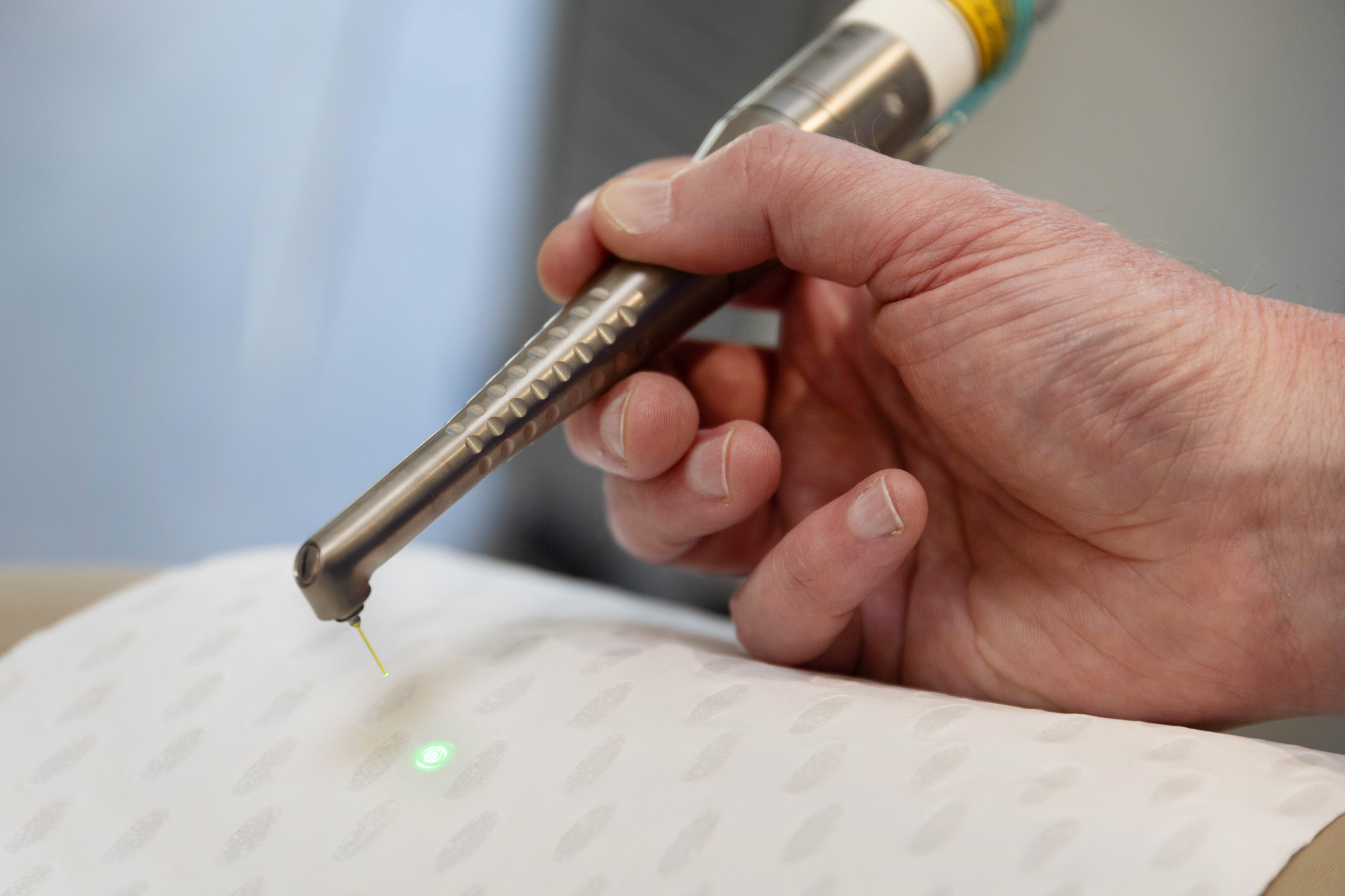 Internal tooth whitening by endodontists in Castle Hill
